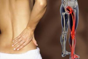 Instant relief sciatica therapy